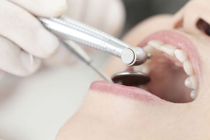 歯周組織を再生する重度の歯周病の治療法