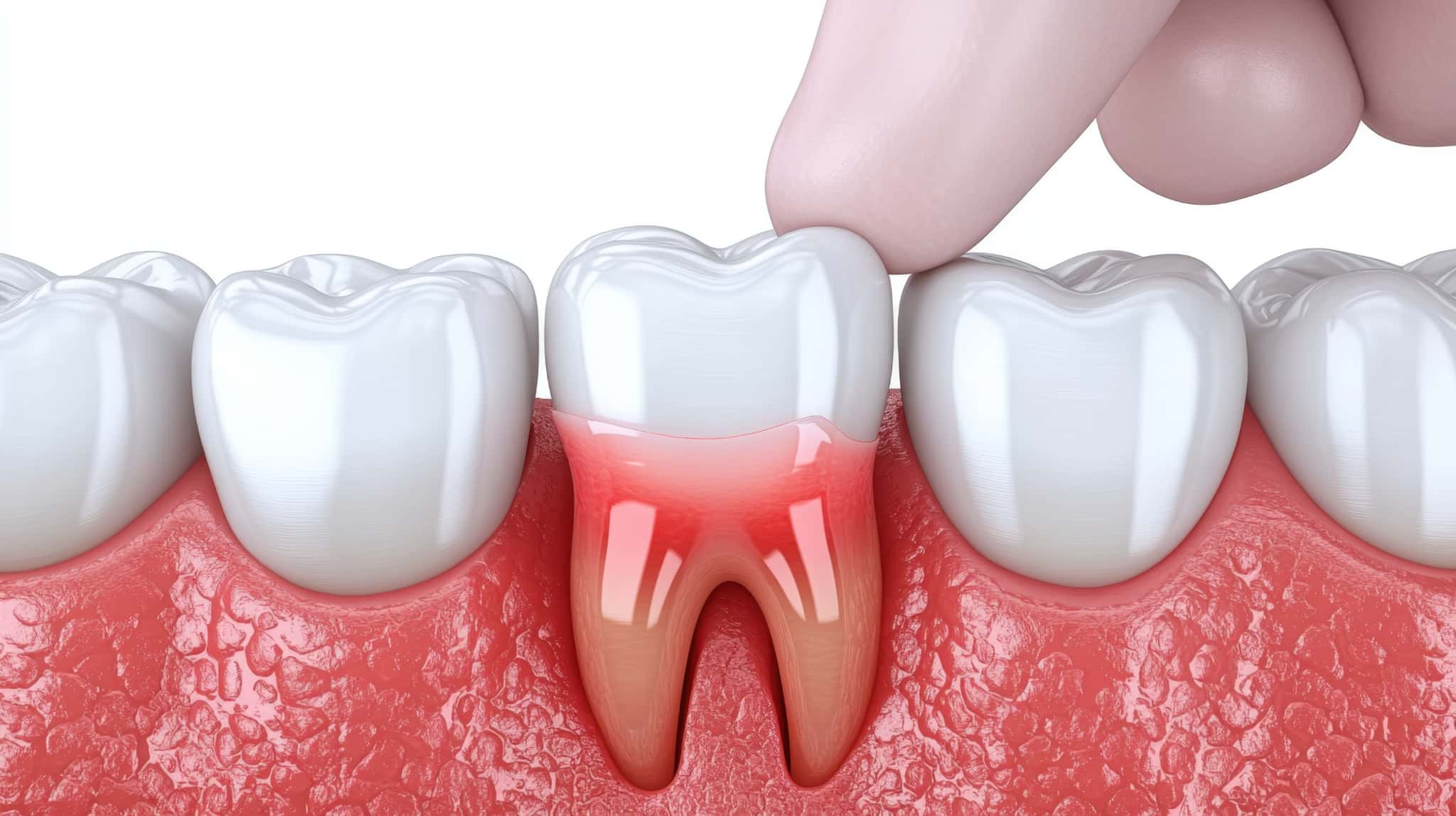 歯周病でぐらつく歯を指でしめしているイメージ