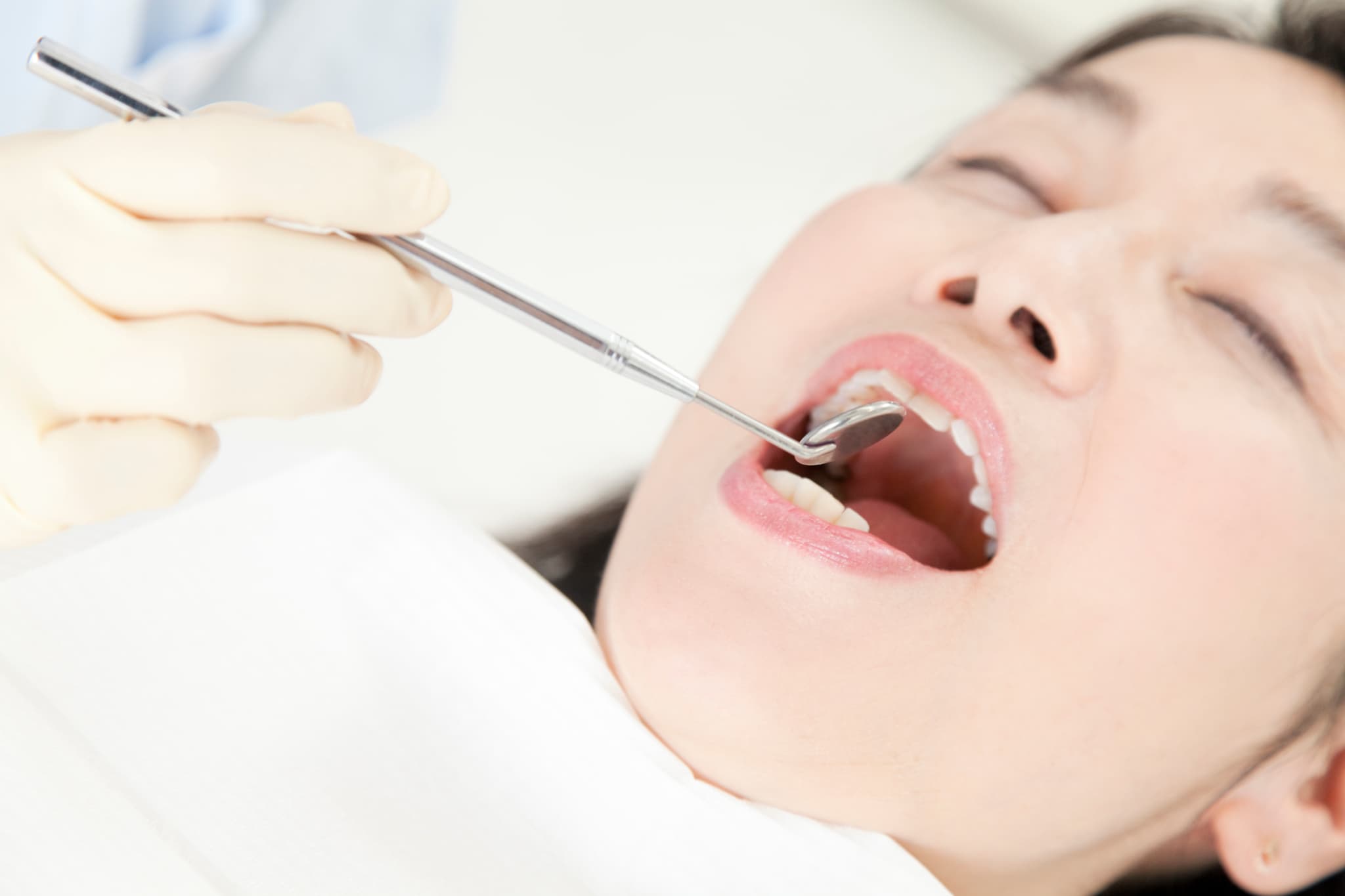 歯石取りの前に口腔内のチェックを受ける女性