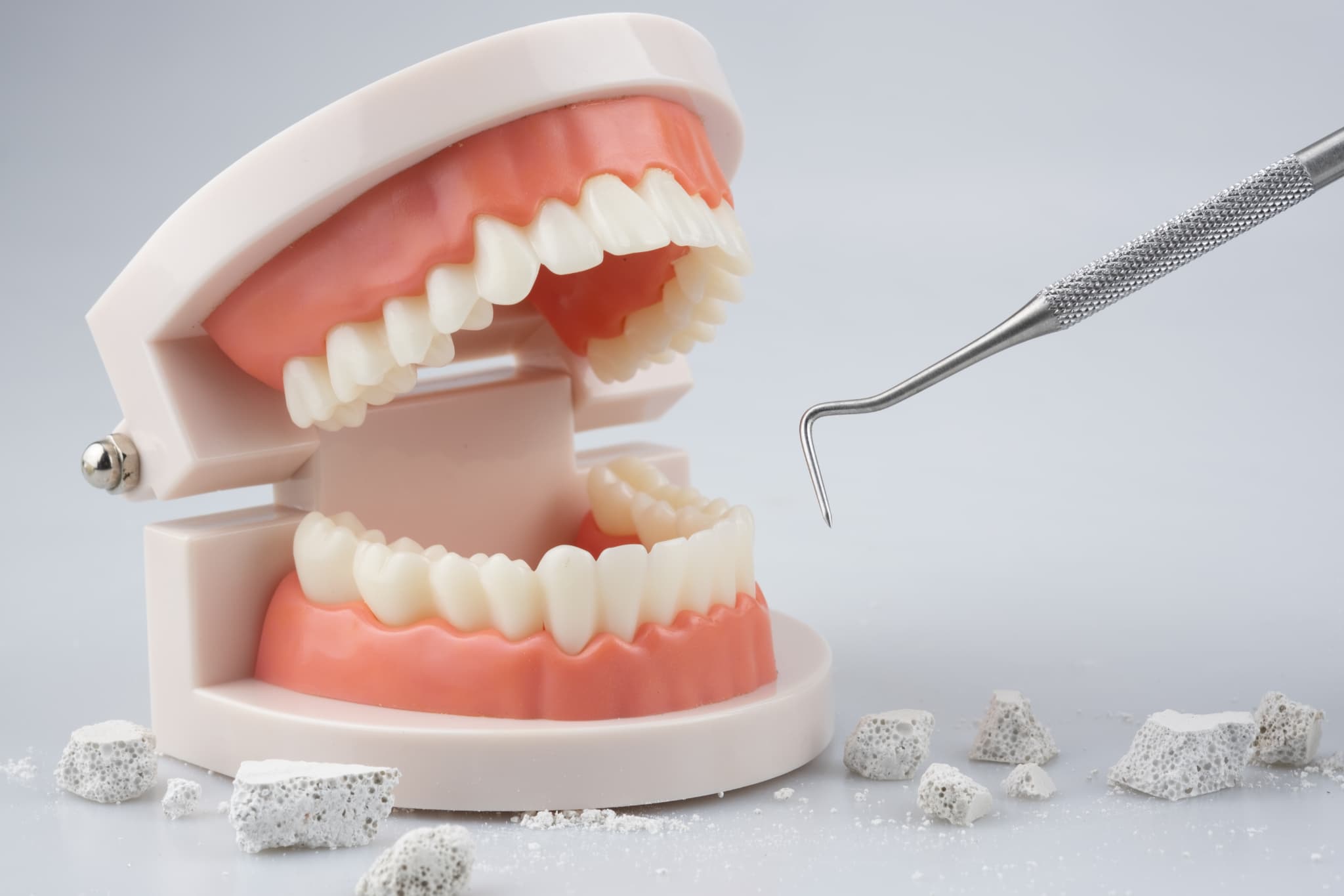 歯石取りのイメージ